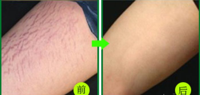 杭州地道整形好醫(yī)院推薦，當(dāng)?shù)鼐用窳λ]的高水平醫(yī)療機構(gòu)