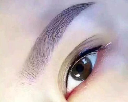 孟慶鵬最新鼻部整形手術(shù)效果怎么樣？贊譽(yù)無(wú)數(shù)的醫(yī)生評(píng)價(jià)+手術(shù)案例分享！鄭州uu們必看~