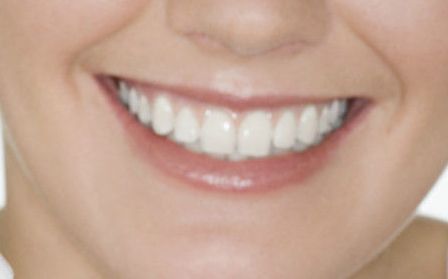 貴陽美貝爾錢剛技術(shù)的用戶評(píng)價(jià)和玻尿酸隆鼻案例分享