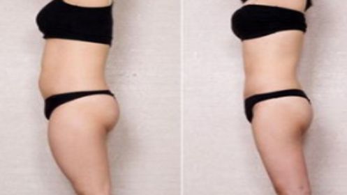 上海有哪些值得推薦的眼部修復(fù)醫(yī)院？前五脫穎而出，口碑極佳，讓你放心選擇