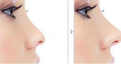 上海眼部整形最佳醫(yī)院排行榜公布！驚喜TOP10等你挖掘