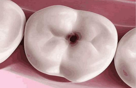 滄州有哪些醫(yī)院可以信賴進(jìn)行開(kāi)眼角手術(shù)？如何選擇更適合自己的醫(yī)院？