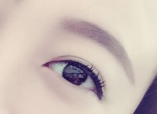 劉春軍豐胸手術(shù)后效果如何？費用怎么樣？醫(yī)生概況+隆胸真實案例圖為參考