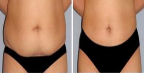 深圳2023年最有口碑的面部填充醫(yī)生推薦！快來看看他們的簡介！