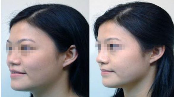 濟南市哪家整形醫(yī)院正規(guī)專業(yè)？推薦可靠的名單