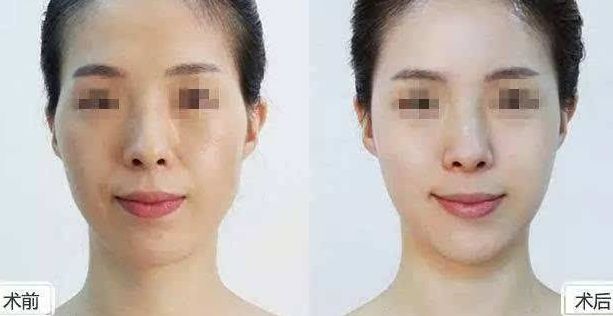 2024年黃石整形醫(yī)院綜合排名及專業(yè)評(píng)測(cè)