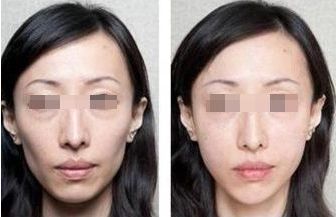 北京頂尖整形醫(yī)院排行榜公布，這三家實(shí)力過硬