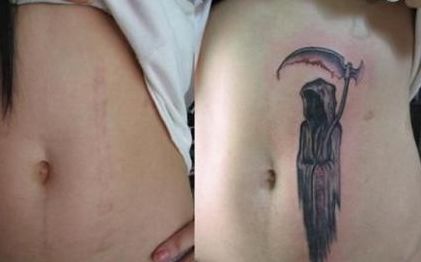 東莞隆鼻手術(shù)排行榜：推薦的前十家醫(yī)院