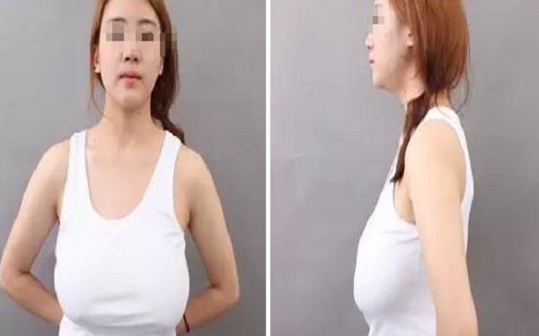 昆明綜合整形醫(yī)院哪家好