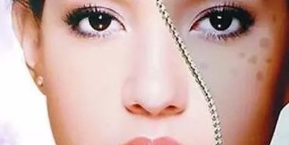 上海眼部修復(fù)專家推薦，治療眼部問題可信賴！