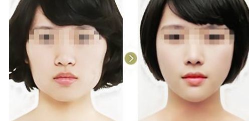 廈門哪家醫(yī)美醫(yī)院口碑最好？專業(yè)特色診療機(jī)構(gòu)一覽