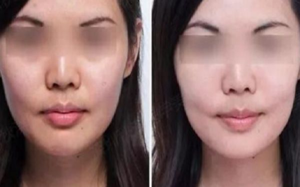 天津頂級(jí)整形醫(yī)院解析