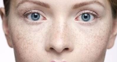 成都江濤醫(yī)生專業(yè)提供雙眼皮修復(fù)服務(wù)，助您重拾雙眼魅力