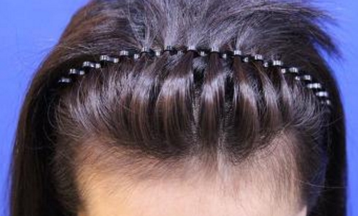 洛陽(yáng)做肋骨鼻哪里好？整形醫(yī)院效果如何？