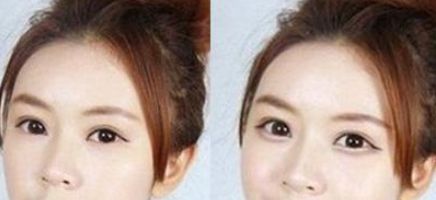 惠陽(yáng)三和醫(yī)院醫(yī)療美容科項(xiàng)目?jī)r(jià)格表及醫(yī)院簡(jiǎn)介解析