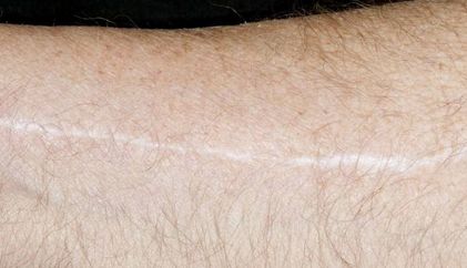 《青島王醫(yī)生的雙眼皮手術(shù)效果如何？專業(yè)簡(jiǎn)介與真實(shí)案例分享》