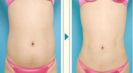 上海頂級(jí)疤痕治療醫(yī)院推薦，排名前三，性價(jià)比超高！