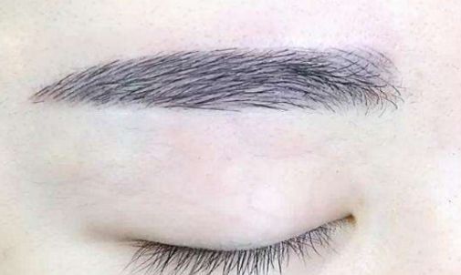 【揭秘】2023年最佳濟(jì)南植發(fā)醫(yī)院名單來襲！