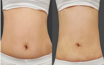 河北雙眼皮修復(fù)頂級(jí)醫(yī)院盤(pán)點(diǎn)，熱門(mén)就醫(yī)選擇一覽！