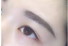 重慶銅雀臺地區(qū)雙眼皮手術頂級醫(yī)生推薦！詳細收費一覽表