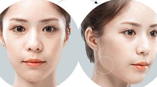 北京五家專業(yè)美容醫(yī)院熱門推薦，實(shí)力醫(yī)院排行榜快來收藏！