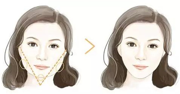 深圳吸脂修復(fù)醫(yī)院哪家專業(yè)？這八強(qiáng)機(jī)構(gòu)到底有何絕技？