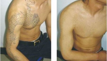 南昌紅谷灘區(qū)有什么好的整形美容醫(yī)院？