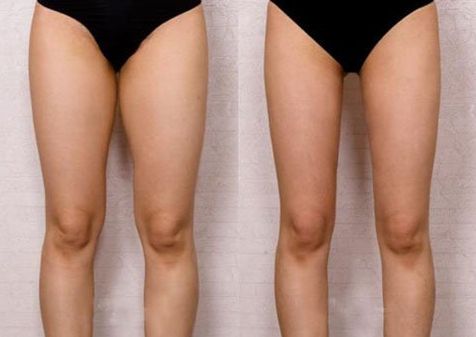 淄博2024年鼻部整形醫(yī)院排行榜發(fā)布