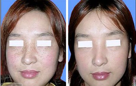 貴陽(yáng)市哪家三級(jí)綜合整形醫(yī)院比較靠譜？