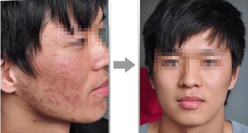 2024年南京整形醫(yī)院推薦：專業(yè)隆鼻哪家好？