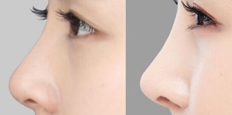 廣州隆胸修復(fù)有哪些值得信賴的醫(yī)院？豐滿胸部是否真的可行？