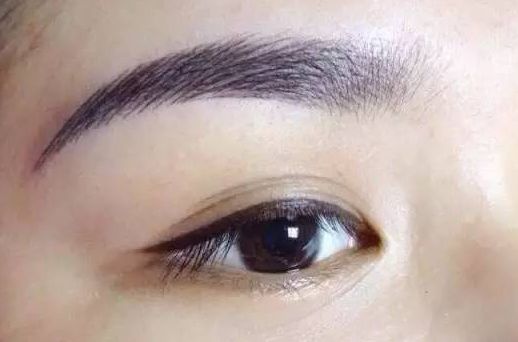 劉恒鑫與崔江波二選一，史上最真實雙眼皮整形案例揭示！點擊查看案例詳情！