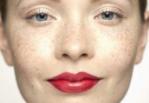 曙光整形醫(yī)院受追捧，隆鼻成功案例分享