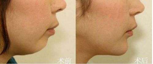 國內(nèi)知名的脫發(fā)治療機(jī)構(gòu)有哪些？這三家你必須了解