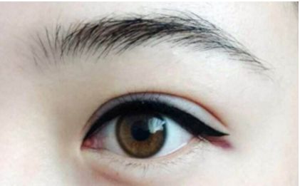 全國蜚聲修復雙眼皮大師排行榜