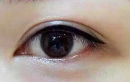 上海9院專(zhuān)家分享軟骨隆鼻案例，LiQingfeng的技術(shù)備受推崇！