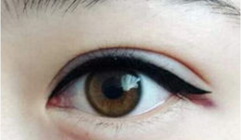 廣東做隆鼻哪家醫(yī)院的技術(shù)好？這五家公立醫(yī)院是值得一試的嗎？