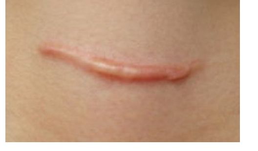 殷佳鵬整形醫(yī)生的技術(shù)與價(jià)格如何？