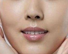 上海眼科專(zhuān)家魏少魁2023年眼睛矯正技術(shù)實(shí)戰(zhàn)分享