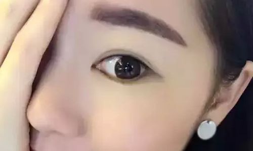 上海顧清鼻子手術(shù)的效果與醫(yī)院醫(yī)生簡(jiǎn)介你了解一下嗎？