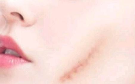 北京雙眼皮手術，牛人醫(yī)生排行揭秘