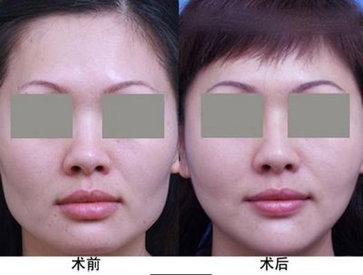 中國最受歡迎的十大整形醫(yī)院評(píng)選結(jié)果公布