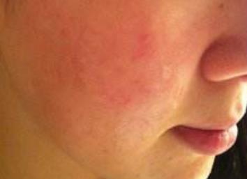 湖南公立醫(yī)院整形科有哪些高水準的本地靠譜機構(gòu)？