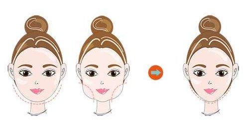 上海星璨整形醫(yī)院，有哪位專家值得信賴和咨詢？醫(yī)術(shù)精湛的實(shí)力高手有誰？