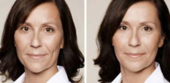 西安哪家醫(yī)院做隆鼻好？整形鼻部醫(yī)院匯總6家