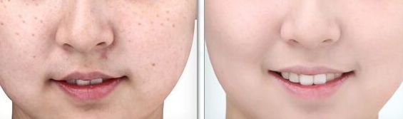 醫(yī)生工作室的預(yù)約方式介紹！蘇薇潔醫(yī)生眼整形工作室的成功案例展示！