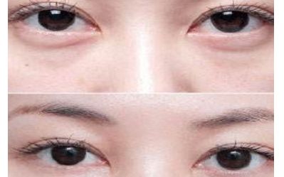 云南雙眼皮醫(yī)生排行榜2023：揭秘5位頂尖專家，讓您輕松煥發(fā)雙目魅力！