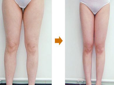 上海柴軍醫(yī)生的鼻子整形案例亮相，效果如何？