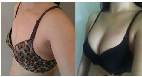 重慶華美眼科醫(yī)生排行榜！五位專家引領(lǐng)潮流，獨(dú)家案例與預(yù)算揭秘！