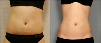 蘇州美容整形醫(yī)院綜合實力巔峰，排名前三不能錯過